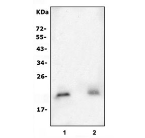 Western blot testing of human 1) Caco-2 and 2) Raji cell lysate with MGMT antibody.  Predicted molecular weight: ~23 kDa.