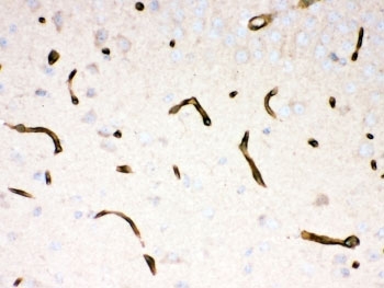 Dystrophin Antibody Mouse Brain Immunohistochemistry. IHC-P: Dystrophin antibody testing of mouse brain tissue.