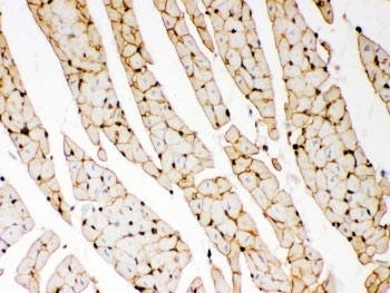 Dystrophin Antibody Rat Heart Immunohistochemistry. IHC-P: Dystrophin antibody testing of rat heart tissue.