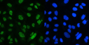 Immunofluorescent staining of FFPE human U-2 OS cells with MSH2 antibody (green) and DAPI nuclear stain (blue). HIER: boil tissue sections in pH6, 10mM citrate buffer, for 20 min and allow to cool before testing.