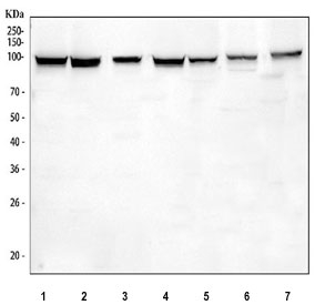 MSH2 Antibody for WB / MSH2 Western Blot Antibody. Western blot analysis of cell lysates using MSH2 Antibody for WB. Lane 1: human K562, Lane 2: human SH-SY5Y, Lane 3: human HEL, Lane 4: human 293T, Lane 5: human A549, Lane 6: rat PC-12, Lane 7: mouse Neuro-2a. A band is detected at approximately 105 kDa, consistent with the predicted molecular weight of MutS homolog 2 / MSH2.