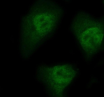 Immunofluorescent staining of FFPE human HeLa cells with NEDD9 antibody. HIER: steam section in pH6 citrate buffer for 20 min.
