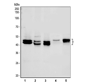 Western blot testing of 1) human HeLa, 2) human MCF7, 3) human Jurkat, 4) rat testis and 5) mouse testis tissue lysate with IkB beta antibody.  Western blot detection of IkB beta/NFKBIB shows a 40-45 kDa doublet across multiple lysates. The spacing is consistent with phosphorylated and unmodified forms of IkB beta.