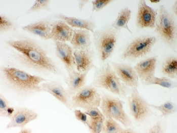 ICC testing of human A549 cells with Nod1 antibody. HIER: steam section in pH6 citrate buffer for 20 min and allow to cool prior to testing.