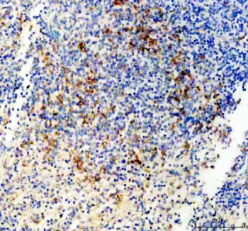 Immunohistochemical staining of FFPE human spleen tissue with P2X5 antibody, HRP-secondary and DAB substrate. HIER: boil tissue sections in pH8 EDTA for 20 min and allow to cool before testing.