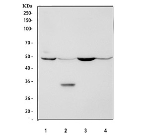 Western blot analysis using P2X5 antibody. Lane 1: rat heart tissue lysates; Lane 2: rat kidney tissue lysates; Lane 3: mouse heart tissue lysates; Lane 4: mouse kidney tissue lysates. The predicted molecular weight of P2X5 (P2RX5) is ~47 kDa, and a band is observed at the expected size. An additional band at ~32 kDa is observed in rat kidney lysate, which may reflect a lower-molecular-weight species or non-specific reactivity.
