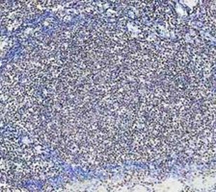 PARP1 Antibody Human Tonsil IHC. Immunohistochemistry analysis of FFPE human tonsil tissue using PARP1 antibody. Lymphoid cell nuclei demonstrate widespread HRP-DAB brown staining consistent with the chromatin-associated localization of PARP1 in DNA repair, genomic surveillance, and nuclear stress-response signaling pathways within proliferative immune cell populations. Nuclei are counterstained blue. Heat-induced epitope retrieval was performed by boiling tissue sections in pH8 EDTA buffer for 20 minutes followed by cooling prior to staining.
