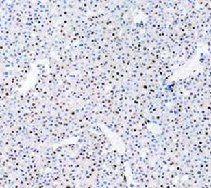 PARP Antibody Mouse Liver IHC. Immunohistochemistry analysis of FFPE mouse liver tissue using PARP1 Antibody / Chromatin Repair Protein Antibody. Hepatocyte nuclei demonstrate diffuse HRP-DAB brown staining consistent with the chromatin-associated role of PARP1 in DNA repair, oxidative stress adaptation, and genomic maintenance pathways within metabolically active hepatic tissue. Nuclei are counterstained blue. Heat-induced epitope retrieval was performed by boiling tissue sections in pH8 EDTA buffer for 20 minutes followed by cooling prior to staining.