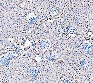 PARP1 Antibody Mouse Kidney IHC. Immunohistochemistry analysis of FFPE mouse kidney tissue using PARP1 antibody. Renal tubular epithelial cell nuclei demonstrate prominent HRP-DAB brown staining consistent with the chromatin-associated localization of PARP1 in DNA damage repair, genomic stability maintenance, and nuclear stress-response signaling pathways. Nuclei are counterstained blue. Heat-induced epitope retrieval was performed by boiling tissue sections in pH8 EDTA buffer for 20 minutes followed by cooling prior to staining.