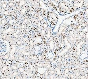 PARP1 Antibody Rat Kidney IHC. Immunohistochemistry analysis of FFPE rat kidney tissue using PARP1 antibody. Renal tubular epithelial cell nuclei demonstrate HRP-DAB brown staining consistent with the chromatin-associated activity of PARP1 in DNA strand break repair, genomic surveillance, and cellular stress-response signaling pathways within kidney tissue. Nuclei are counterstained blue. Heat-induced epitope retrieval was performed by boiling tissue sections in pH8 EDTA buffer for 20 minutes followed by cooling prior to staining.