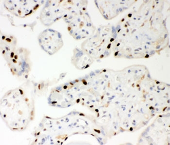 PARP1 Antibody Human Placenta IHC. Immunohistochemistry analysis of FFPE human placenta tissue using PARP1 antibody. Placental trophoblast cell nuclei demonstrate HRP-DAB brown staining consistent with the chromatin-associated activity of PARP1 in DNA repair, genomic stability maintenance, and nuclear stress-response signaling pathways within actively remodeling placental tissue. Nuclei are counterstained blue. Heat-induced epitope retrieval was performed by steaming tissue sections in pH6 citrate buffer prior to staining.