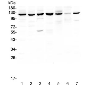 PARP1 Antibody Multi-Species WB. Western blot analysis of human, rat, and mouse cell lysates using PARP1 antibody at 0.5 ug/ml. Lane 1: human HeLa lysate, Lane 2: human HepG2 lysate, Lane 3: human COLO-320 lysate, Lane 4: human Jurkat lysate, Lane 5: rat PC-12 lysate, Lane 6: mouse NIH 3T3 lysate, Lane 7: mouse HEPA 1-6 lysate. A predominant band is detected near 116 kDa, consistent with the predicted molecular weight of full-length PARP1. Additional lower molecular weight signal near approximately 55-89 kDa in selected samples may reflect proteolytic processing or cleavage-associated PARP1 fragments containing the catalytic domain. The observed expression pattern supports the widespread nuclear distribution of this chromatin-associated repair protein involved in DNA strand break signaling, genomic stability maintenance, and cellular stress-response pathways across multiple mammalian cell types.