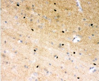 PARP1 Antibody Rat Brain IHC. Immunohistochemistry analysis of FFPE rat brain tissue using PARP1 antibody. Neuronal and glial cell nuclei demonstrate HRP-DAB brown staining consistent with the chromatin-associated localization of PARP1 in DNA repair, genomic maintenance, and oxidative stress-response signaling pathways within neural tissue. Nuclei are counterstained blue. Heat-induced epitope retrieval was performed by steaming tissue sections in pH6 citrate buffer prior to staining.