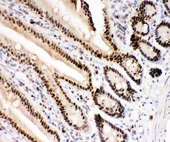 PARP1 Antibody Mouse Intestine IHC. Immunohistochemistry analysis of FFPE mouse intestine tissue using PARP1 antibody. Intestinal epithelial cell nuclei demonstrate strong HRP-DAB brown staining consistent with the chromatin-associated role of PARP1 in DNA strand break repair, genomic maintenance, and nuclear stress-response signaling within rapidly proliferating epithelial tissue. Nuclei are counterstained blue. Heat-induced epitope retrieval was performed by steaming tissue sections in pH6 citrate buffer prior to staining.