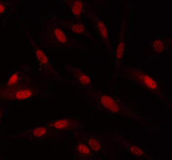 Immunofluorescent staining of FFPE human U-87 MG cells with PIN1 antibody (red). HIER: steam section in pH6 citrate buffer for 20 min.