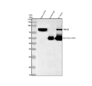 Immunoprecipitation of PKC beta protein from 500ug of human Jurkat whole cell lysate with 2ug of PKC beta antibody. Predicted molecular weight ~76 kDa.