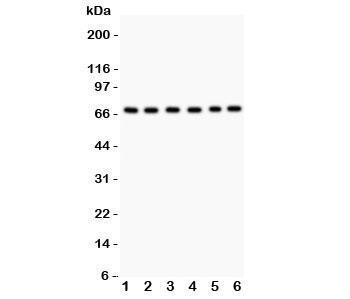 PKC Iota Antibody / PRKCI Antibody WB. Western blot analysis of SHG-44, A549, U87, 293T, HeLa, and Jurkat cell lysates using PKC Iota Antibody / PRKCI Antibody. A single prominent band is detected at approximately 68 kDa in each cell line, consistent with the predicted molecular weight of PRKCI (PKC iota), supporting specific detection of the endogenous protein across multiple human cell types.