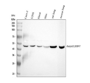 HSP47 Antibody Human and Rodent Lung WB. Western blot analysis was performed using HSP47 Antibody on lane 1: human Caco-2, lane 2: human U2OS, lane 3: human HaCaT, lane 4: human SiHa, lane 5: rat lung, and lane 6: mouse lung lysates. A distinct band is detected at approximately 46 kDa in each sample, matching the predicted molecular weight of HSP47 (SERPINH1). The strong signal observed in both rat and mouse lung tissues is consistent with the abundant collagen synthesis occurring within pulmonary tissue. This HSP47 Antibody, a Collagen Chaperone Antibody, is well suited for Western blot studies of collagen biosynthesis, endoplasmic reticulum function, extracellular matrix remodeling, and fibrosis research.