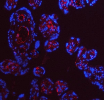 ApoE Antibody Human Placenta IF. Immunofluorescent staining of FFPE human placental tissue with ApoE antibody (red). Heat-induced epitope retrieval (HIER) was performed by steaming sections in pH 8 EDTA buffer for 20 minutes prior to staining. Nuclei are counterstained with DAPI (blue). ApoE immunoreactivity is observed predominantly within the cytoplasm of placental trophoblast cells, consistent with the expected localization of this lipid transport protein involved in cholesterol homeostasis and lipoprotein metabolism.