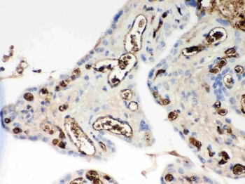 ApoE Antibody Human Placenta IHC. Immunohistochemical staining of FFPE human placental tissue with ApoE antibody. Heat-induced epitope retrieval (HIER) was performed by boiling tissue sections in pH 6 citrate buffer for 20 minutes and allowing them to cool prior to staining. ApoE immunoreactivity is observed predominantly within the cytoplasm and along the membranes of placental trophoblast cells, consistent with the expected localization of this lipid transport protein involved in cholesterol homeostasis and lipoprotein metabolism. Cell nuclei are counterstained with hematoxylin (blue).
