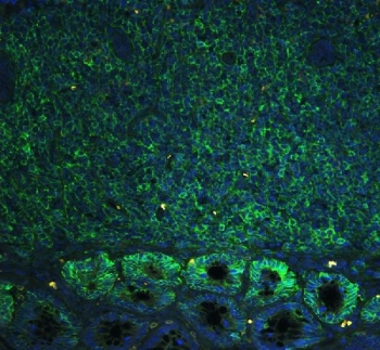 CD44 Antibody Rat Lymph Tissue IF. Immunofluorescence analysis of CD44 / CD44 antigen expression in FFPE rat lymph tissue using rabbit polyclonal antibody (green) with DAPI nuclear stain (blue). Diffuse membrane-associated fluorescence is observed throughout lymphoid regions, consistent with widespread CD44 expression on immune cells. The staining pattern highlights tissue organization and supports its use for examining CD44 distribution in lymphoid tissue. Heat induced epitope retrieval was performed by steaming tissue sections in pH 6 citrate buffer for 20 min.