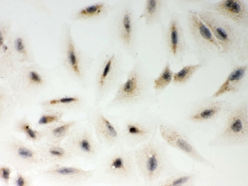 ICC testing of FFPE human A549 cells with LYRIC antibody. HIER: steam section in pH6 citrate buffer for 20 min and allow to cool prior to testing.