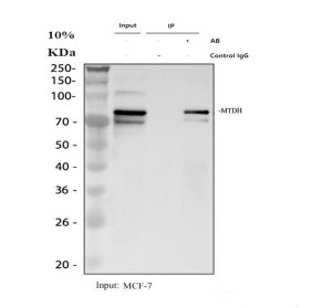 Metadherin Antibody Human Breast Cancer Cell IP. Immunoprecipitation of MTDH from human MCF-7 cell lysate using Metadherin antibody followed by Western blot analysis demonstrated efficient enrichment of the characteristic 70-75 kDa MTDH doublet. Lane 1 shows the input lysate, lane 2 is the rabbit IgG negative control, and lane 3 contains the immunoprecipitated MTDH complex obtained using 2 ug of antibody from 500 ug of lysate. The observed doublet is consistent with the known post-translationally modified forms of MTDH, which commonly migrate above the predicted molecular weight of approximately 64 kDa. This Metadherin Antibody, also called an MTDH Antibody, is useful for investigating protein interactions, tumor progression, metastasis, oncogenic signaling, and cancer biology.