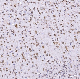 IHC staining of FFPE mouse brain tissue with Optineurin antibody. HIER: boil tissue sections in pH8 EDTA for 20 min and allow to cool before testing.  