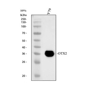 OTX2 Antibody Human Retinoblastoma Cell WB. Western blot demonstrates detection of OTX2 in human Y79 retinoblastoma cell lysate. A prominent immunoreactive band is observed at approximately 37 kDa, slightly above the predicted molecular weight of approximately 32 kDa, consistent with reported electrophoretic migration of orthodenticle homeobox 2. The robust expression in Y79 cells reflects the well-established role of OTX2 in retinal development and retinoblastoma biology. This OTX2 Antibody, also called Orthodenticle Homeobox 2 Antibody, is suitable for studies of neural development, retinal biology, and transcriptional regulation.