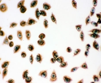 ICC testing of PRDX1 antibody and human SMMC-7721 cells.