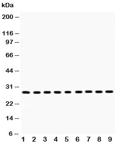 Western blot testing of PRDX3 antibody and Lane 1:  rat brain;  2: mouse brain;  3: rat skeletal muscle;  4: mouse skeletal muscle;  5: human U-2 0S;  6: HeLa;  7: SMMC-7721;  8: RH35;  9: A549 lysate.  Expected molecular weight: ~28 kDa.