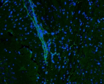 Vimentin Antibody / Tumor Microenvironment Immunofluorescence Marker Antibody. Immunofluorescence analysis of Vimentin / VIM in mouse brain tissue demonstrating green cytoplasmic and filamentous staining in stromal and supporting cell populations. The Vimentin Antibody / Tumor Microenvironment Immunofluorescence Marker Antibody used as a tumor microenvironment immunofluorescence marker highlights Vimentin-positive cells with elongated morphology and network-like distribution within the tissue. Nuclei are counterstained with DAPI (blue), supporting visualization of stromal architecture and microenvironment organization.