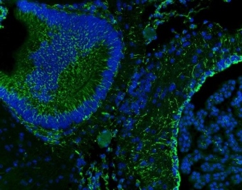 Vimentin Antibody / Tumor Microenvironment Immunofluorescence Marker Antibody. Immunofluorescence analysis of Vimentin / VIM in rat brain tissue demonstrating green cytoplasmic and filamentous staining in stromal and supporting cell populations, including cells lining vascular and parenchymal structures. The Vimentin Antibody / Tumor Microenvironment Immunofluorescence Marker Antibody highlights Vimentin-positive cells with elongated morphology and network-like distribution within the tissue, consistent with microenvironment-associated cell populations. Nuclei are counterstained with DAPI (blue), supporting visualization of stromal architecture and tissue organization.