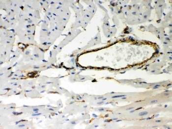 Vimentin Antibody / Tumor Microenvironment Marker Antibody Mouse Heart IHC. Immunohistochemical staining of FFPE mouse heart tissue using Vimentin Antibody / Tumor Microenvironment Marker Antibody. Vimentin expression is detected predominantly in vascular endothelial cells and interstitial stromal cells, consistent with its role as a marker of the cardiac stromal microenvironment and its involvement in cytoskeletal organization, tissue remodeling, and vascular integrity. Heat-induced epitope retrieval was performed by boiling tissue sections in pH 8 EDTA for 20 minutes followed by cooling prior to immunostaining.