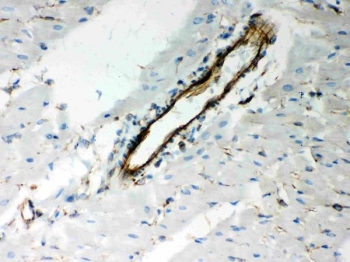 Vimentin Antibody / Tumor Microenvironment Marker Antibody Rat Heart IHC. Immunohistochemical staining of FFPE rat heart tissue using Vimentin Antibody / Tumor Microenvironment Marker Antibody. Vimentin expression is detected predominantly in vascular endothelial cells and surrounding stromal cells, consistent with its role as a marker of the cardiac microenvironment and its involvement in cytoskeletal organization, vascular homeostasis, and tissue remodeling. Heat-induced epitope retrieval was performed by boiling tissue sections in pH 8 EDTA for 20 minutes followed by cooling prior to immunostaining.