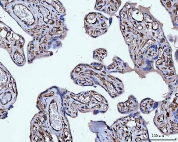 Vimentin Antibody / Tumor Microenvironment Marker Antibody Human Placenta IHC. Immunohistochemical staining of FFPE human placental tissue using Vimentin Antibody / Tumor Microenvironment Marker Antibody. Vimentin expression is observed predominantly within stromal cells and vascular components of the placental microenvironment, consistent with its role in maintaining structural integrity, supporting mesenchymal cell function, and facilitating tissue remodeling during placental development. Heat-induced epitope retrieval was performed by boiling tissue sections in pH 8 EDTA for 20 minutes followed by cooling prior to immunostaining.