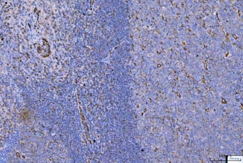 Vimentin Antibody / Tumor Microenvironment Marker Antibody Human Tonsil IHC. Immunohistochemical staining of FFPE human tonsil tissue using Vimentin Antibody / Tumor Microenvironment Marker Antibody. Vimentin expression is observed predominantly within stromal cells, vascular endothelial cells, and supporting mesenchymal cells of the tonsillar microenvironment, consistent with its role in maintaining tissue architecture, immune cell support, and extracellular matrix remodeling. Heat-induced epitope retrieval was performed by boiling tissue sections in pH 8 EDTA for 20 minutes followed by cooling prior to immunostaining.