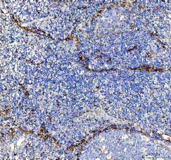 IHC staining of FFPE human tonsil tissue with P-Selectin antibody, HRP-labeled secondary and DAB substrate. HIER: boil tissue sections in pH8 EDTA for 20 min and allow to cool before testing.