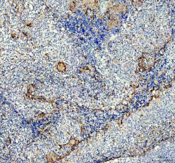 IHC staining of FFPE human tonsil tissue with P-Selectin antibody, HRP-labeled secondary and DAB substrate. HIER: boil tissue sections in pH8 EDTA for 20 min and allow to cool before testing.