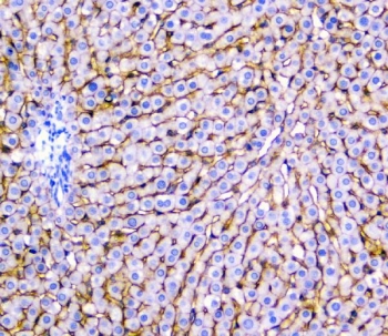 IHC testing of FFPE rat liver with NTCP antibody. HIER: Boil the paraffin sections in pH8 EDTA buffer for 20 minutes and allow to cool prior to staining.