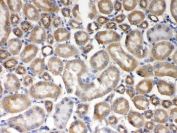 IHC testing of FFPE mouse kidney with AIM2 antibody. HIER: Boil the paraffin sections in pH 6, 10mM citrate buffer for 20 minutes and allow to cool prior to staining.