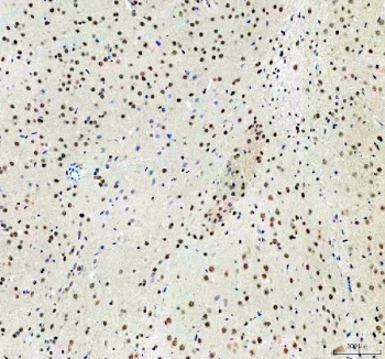 IHC staining of FFPE rat brain tissue with CLOCK antibody. HIER: boil tissue sections in pH8 EDTA for 20 min and allow to cool before testing.