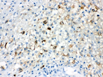 IHC testing of FFPE human appendicitis tissue with TLR5 antibody. HIER: Boil the paraffin sections in pH 6, 10mM citrate buffer for 20 minutes and allow to cool prior to staining.