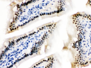 IHC testing of FFPE mouse intestine with ZBTB7A antibody. HIER: Boil the paraffin sections in pH 6, 10mM citrate buffer for 20 minutes and allow to cool prior to staining.