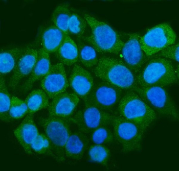 Immunofluorescent staining of FFPE human Caco-2 cells with STAU1 antibody (green) and DAPI nuclear stain (blue). HIER: steam section in pH6 citrate buffer for 20 min.