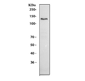 Ceruloplasmin Antibody HepG2 Western Blot. Western blot analysis of human HepG2 cell lysate using Ceruloplasmin Antibody / Iron Metabolism Protein Antibody demonstrates a distinct band at approximately 130-140 kDa, consistent with expression of Ceruloplasmin (CP). Ceruloplasmin is a multicopper ferroxidase that plays a central role in iron metabolism, copper transport, and maintenance of metal ion homeostasis. By catalyzing the oxidation of ferrous iron to ferric iron, Ceruloplasmin facilitates iron transport and utilization while contributing to systemic mineral balance and cellular metabolic regulation. The observed molecular weight is consistent with the heavily glycosylated nature of Ceruloplasmin, which commonly migrates above its predicted molecular weight of approximately 122 kDa during SDS-PAGE analysis.