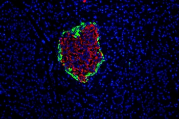 Immunofluorescent staining of rat pancreas with GLP-1 antibody (green) at 1ug/ml and DAPI nuclear stain (blue). HIER: Boil the paraffin sections in pH 6, 10mM citrate buffer for 20 minutes and allow to cool prior to staining.