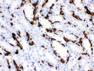 Band 3 Antibody Rodent Kidney IHC. Immunohistochemical staining of FFPE rat kidney tissue using Band 3 Antibody / Anion Exchange Protein 1 Antibody demonstrates strong membranous and cytoplasmic HRP-DAB brown staining within renal tubular epithelial cells. Band 3 (AE1/SLC4A1) is a chloride/bicarbonate exchanger that plays a critical role in bicarbonate transport, acid-base regulation, and maintenance of cellular ionic homeostasis. In addition to its well-established function in erythrocyte membranes, AE1 is expressed in specialized renal epithelial cells where it contributes to physiologic acid-base balance through regulation of bicarbonate and chloride exchange. The observed tubular staining pattern is consistent with the established role of Band 3 family proteins in kidney ion transport and maintenance of renal homeostasis. HIER: boil paraffin sections in pH 6, 10 mM citrate buffer for 20 minutes and allow to cool prior to staining.