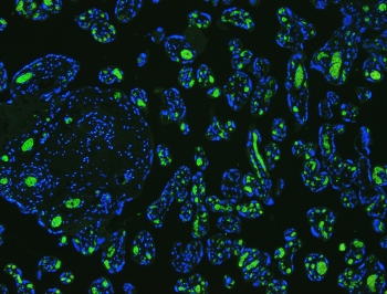 Band 3 Antibody Human Placenta IF. Immunofluorescent staining of FFPE human placenta tissue using Band 3 Antibody / Anion Exchange Protein 1 Antibody demonstrates strong green fluorescence within placental trophoblast cell populations, while nuclei are counterstained with DAPI (blue). Band 3 (AE1/SLC4A1) is a chloride/bicarbonate exchanger that mediates transmembrane ion transport and contributes to maintenance of cellular acid-base balance and ionic homeostasis. Although best known as a major erythrocyte membrane protein, AE1-related transport mechanisms are also associated with specialized epithelial cells that require regulated bicarbonate and chloride exchange. The observed trophoblast-associated fluorescence pattern is consistent with expression of anion transport proteins involved in placental physiology, membrane transport, and cellular homeostasis. HIER: boil paraffin sections in pH 6, 10 mM citrate buffer for 20 minutes and allow to cool prior to staining.
