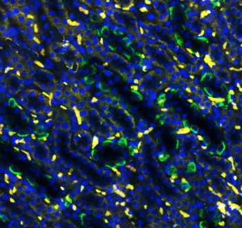 Band 3 Antibody Renal Tubule IF. Immunofluorescent staining of FFPE rat kidney tissue using Band 3 Antibody / Anion Exchange Protein 1 Antibody demonstrates strong green fluorescence within renal tubular epithelial structures, while nuclei are counterstained with DAPI (blue). Band 3 (AE1/SLC4A1) is a chloride/bicarbonate exchanger that plays a critical role in bicarbonate transport, acid-base regulation, and maintenance of cellular ionic homeostasis. In the kidney, AE1 is expressed in specialized epithelial cell populations where it contributes to physiologic mechanisms responsible for systemic acid-base balance and bicarbonate handling. The observed tubular fluorescence pattern is consistent with the established role of Anion Exchange Protein 1 in renal ion transport and epithelial homeostasis. HIER: boil paraffin sections in pH 6, 10 mM citrate buffer for 20 minutes and allow to cool prior to staining.